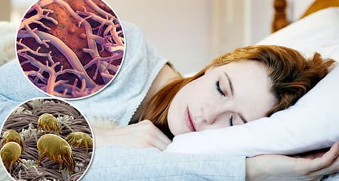 آلودگی های رختخواب